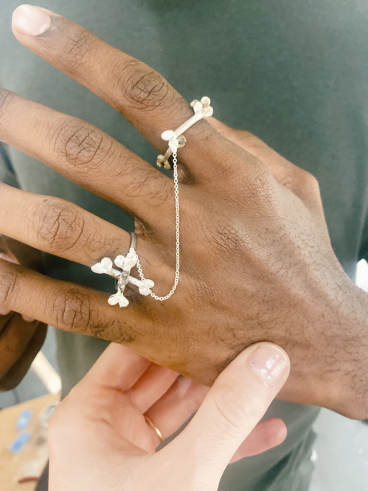 Double bone long-life ring